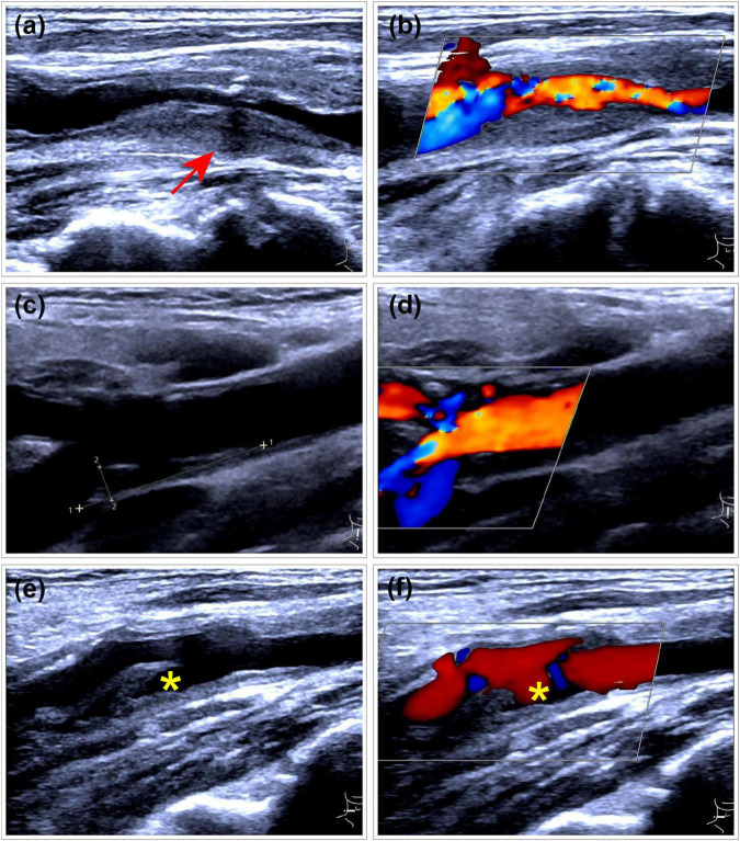 FIGURE 3