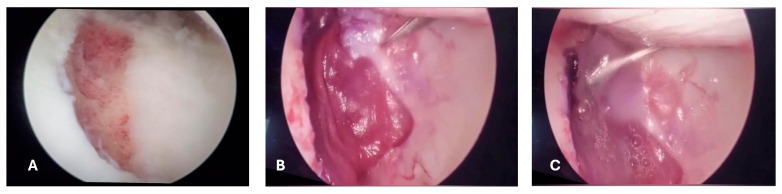 Figure 6
