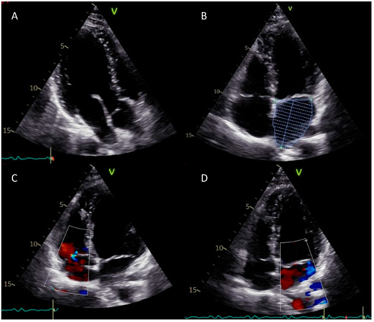 Figure 4