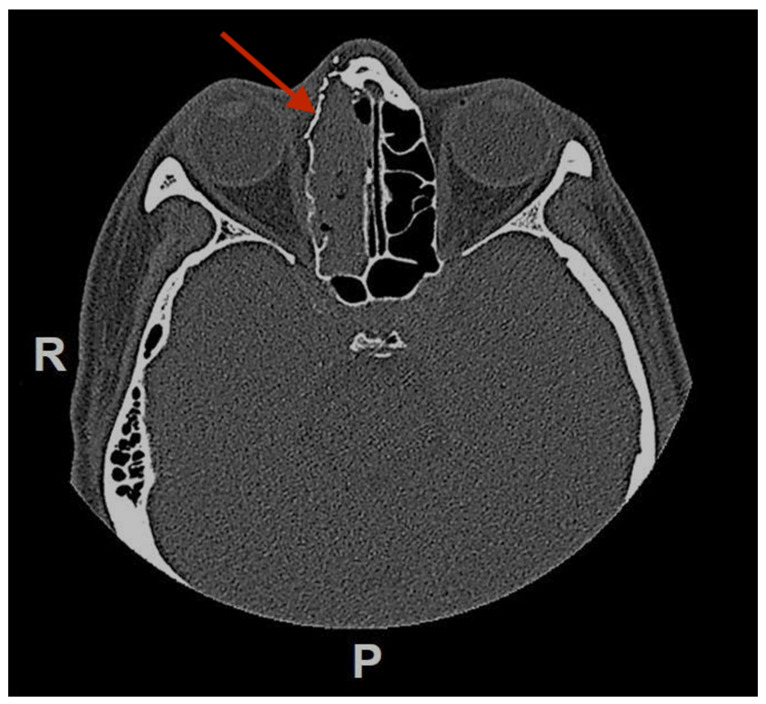 Figure 7