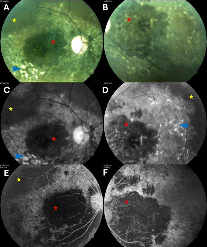 Fig 2