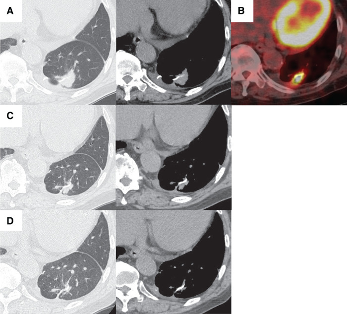Fig. 4