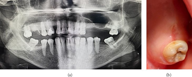 Figure 6