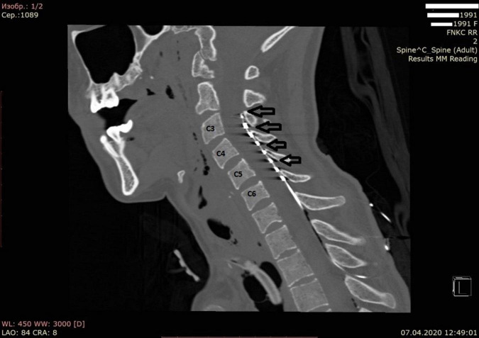 FIGURE 1