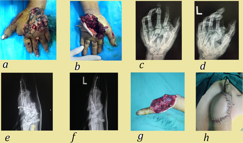 Figure 4