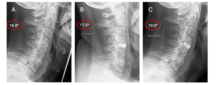 Figure 13