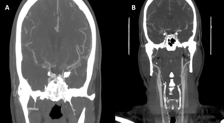 Figure 9