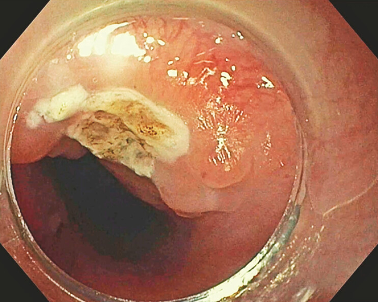 Fig. 2