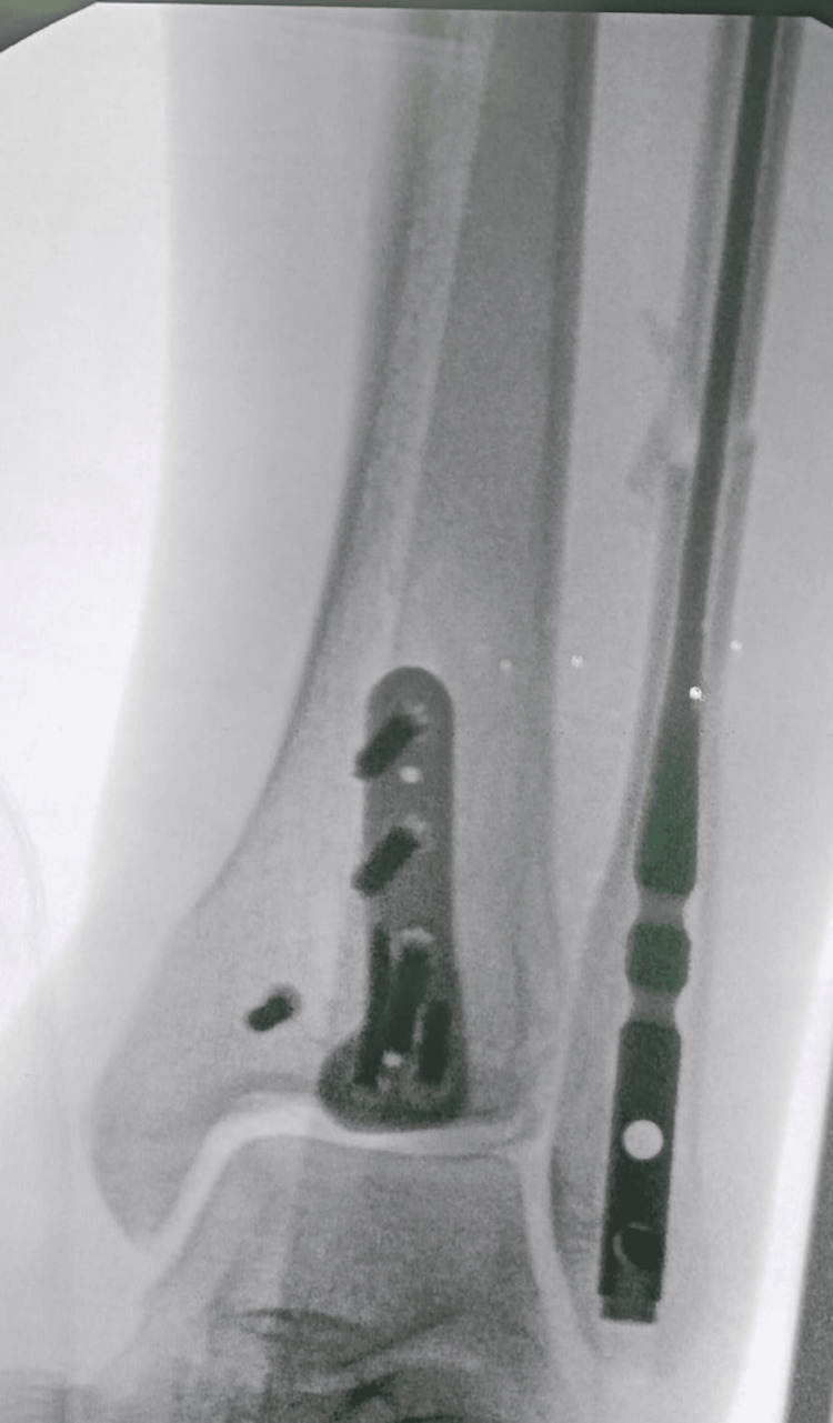 Figure 6