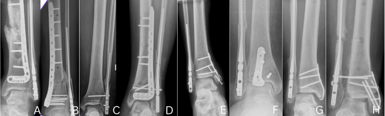 Figure 9