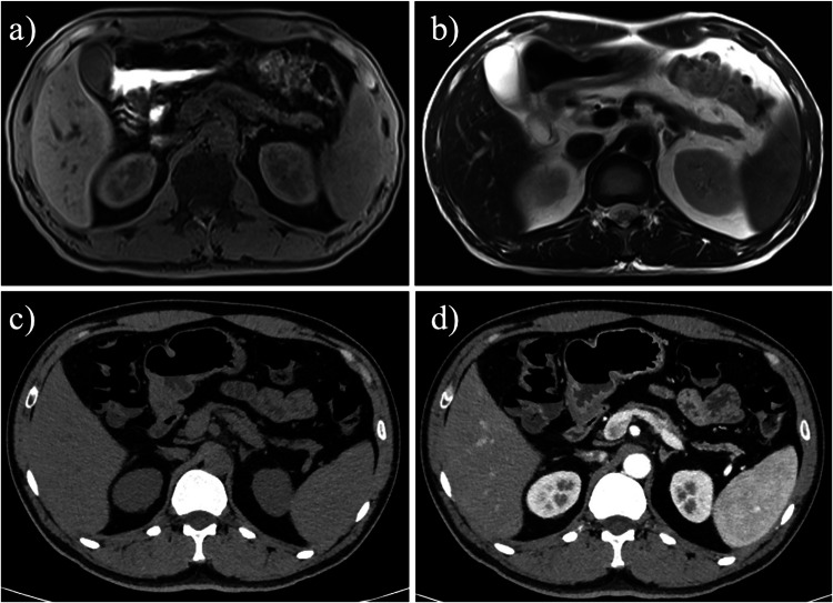 Figure 11