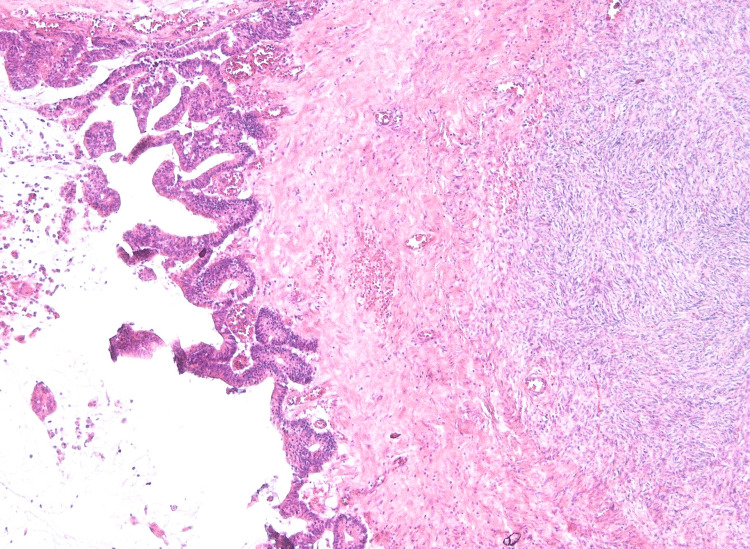 Figure 11