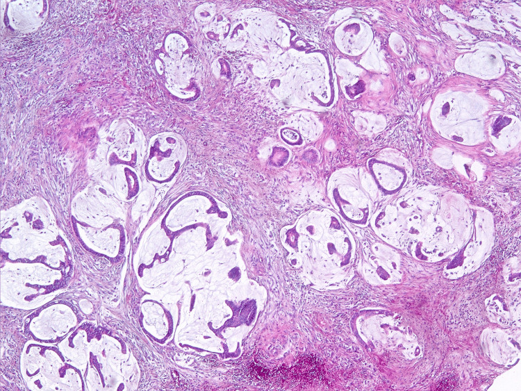 Figure 14