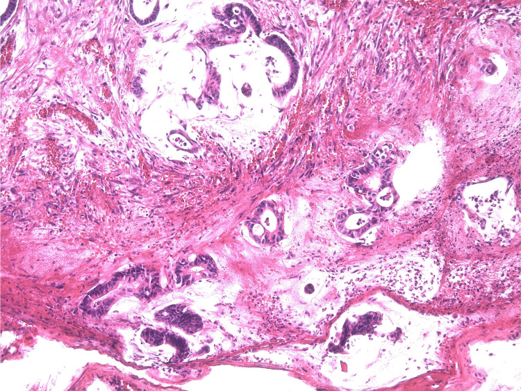 Figure 15