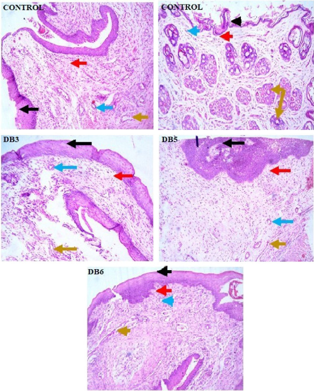Figure 12