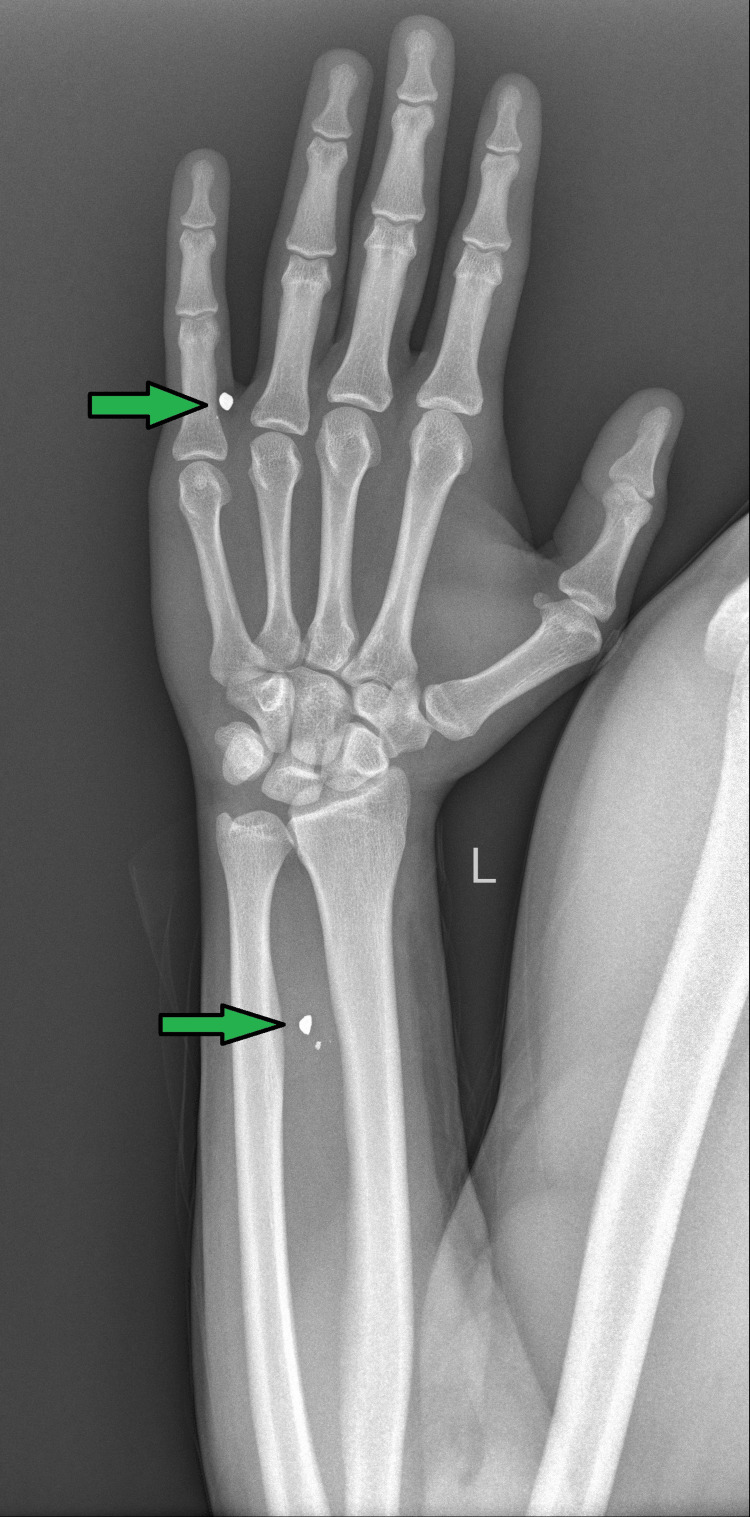 Figure 6