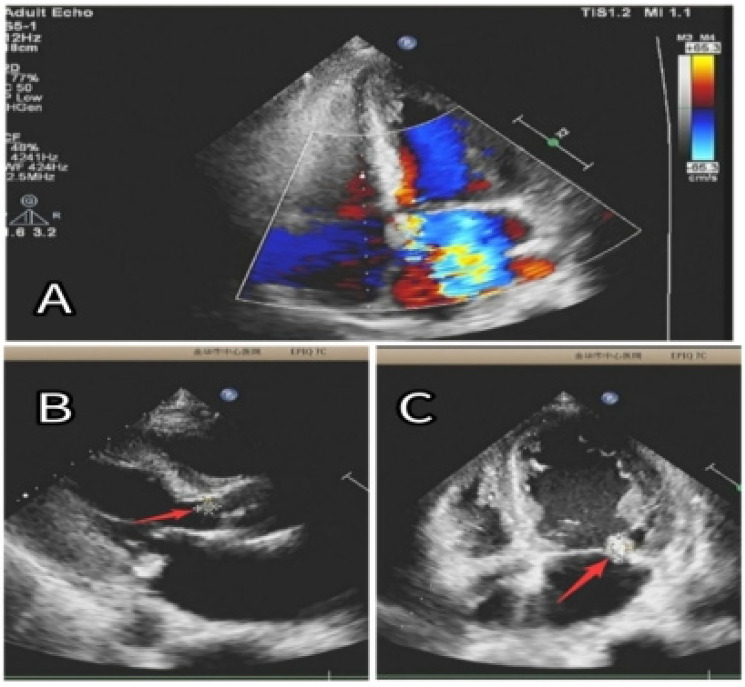 Figure 2