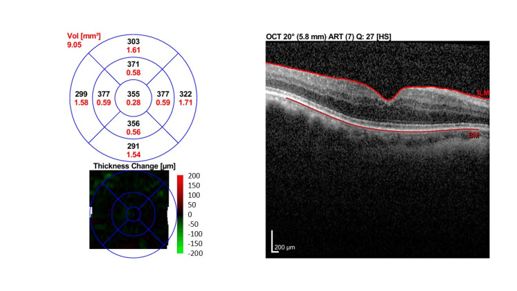 Figure 6