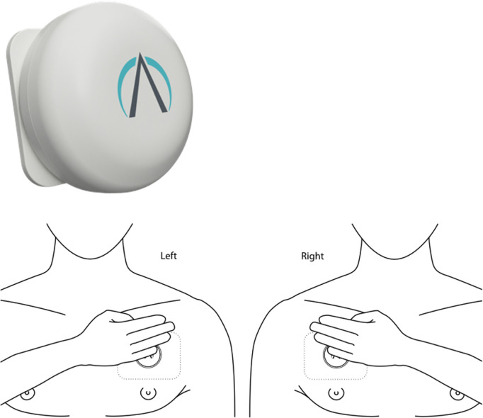 Fig 3