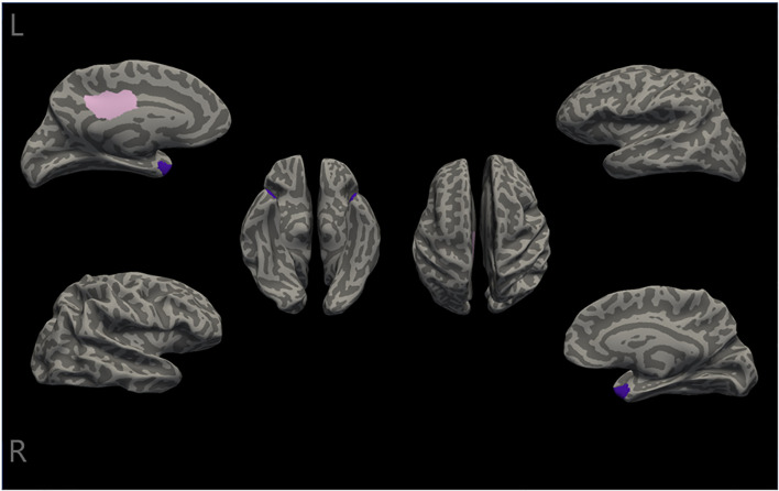 Figure 2