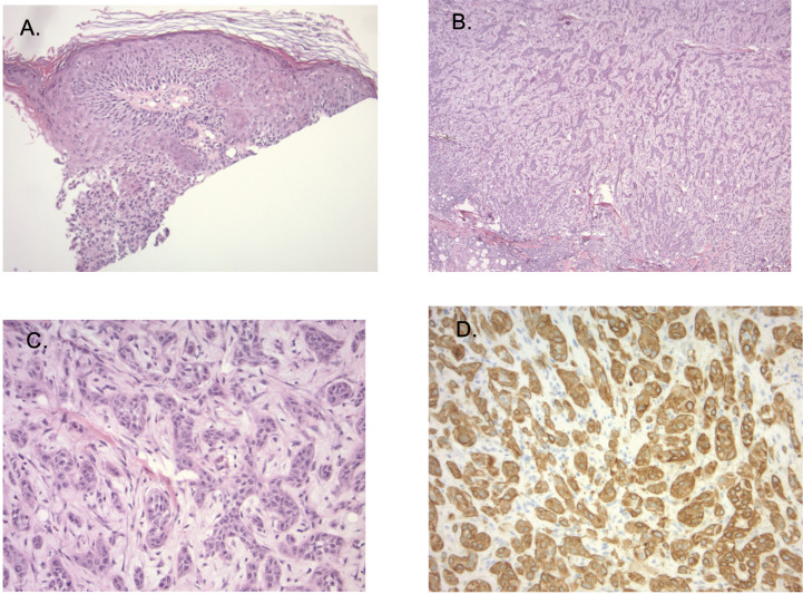 Figure 2