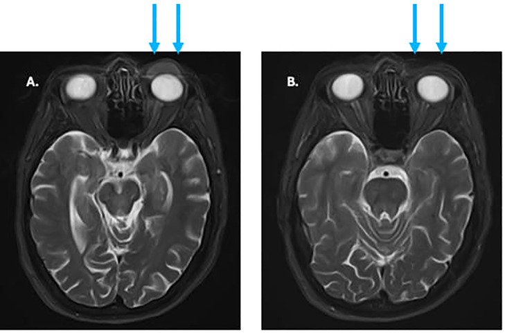 Figure 5