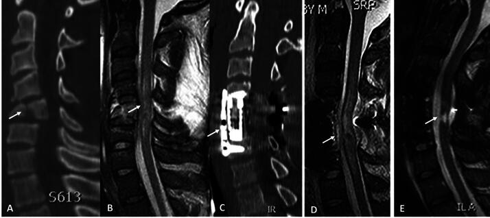 FIG. 1