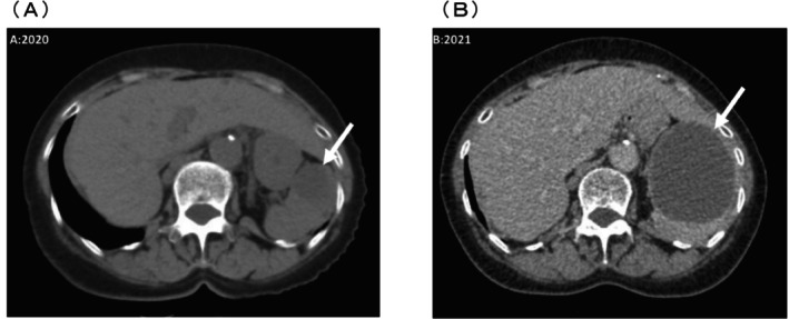 FIGURE 1