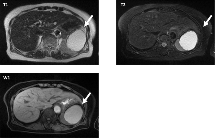 FIGURE 2
