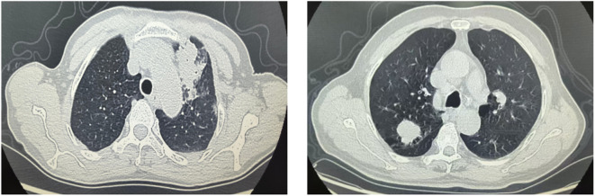 Figure 1