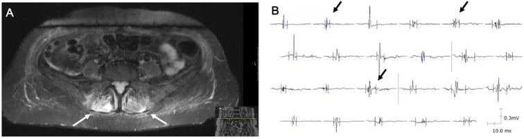 Figure 3