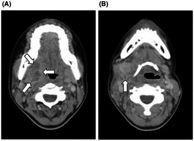 FIGURE 3