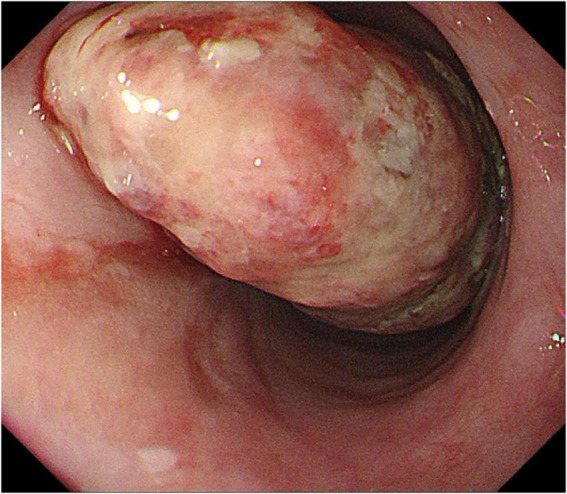 FIGURE 1