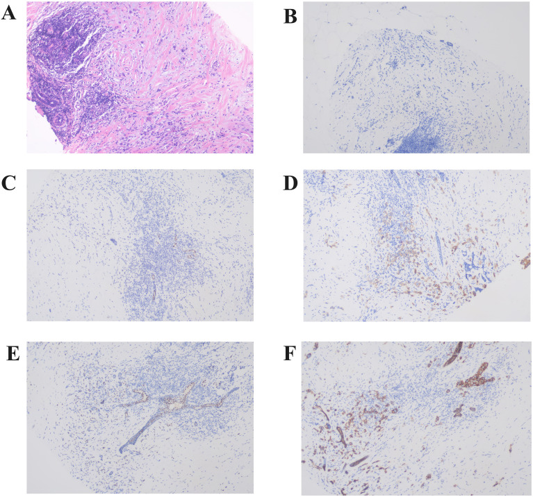 Figure 2