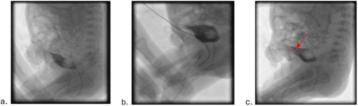 FIGURE 1