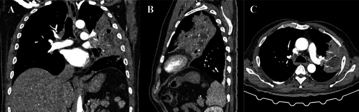 FIGURE 2