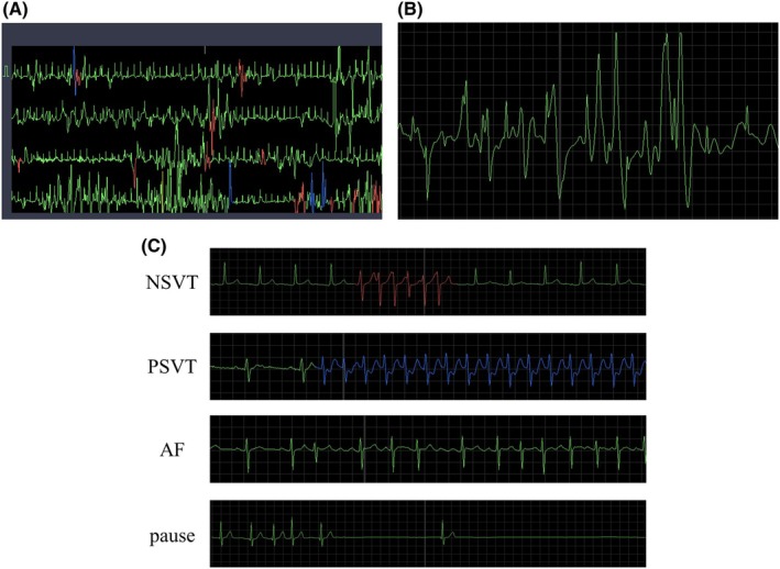 FIGURE 3