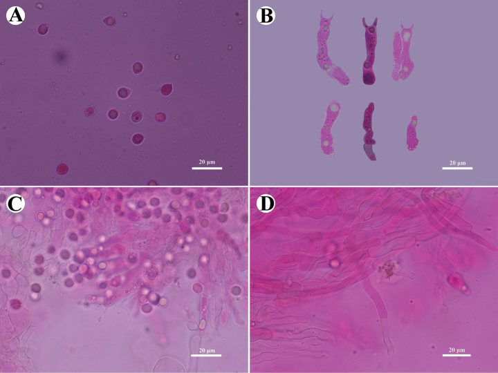 Figure 14