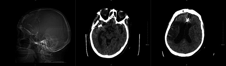 Figure 6