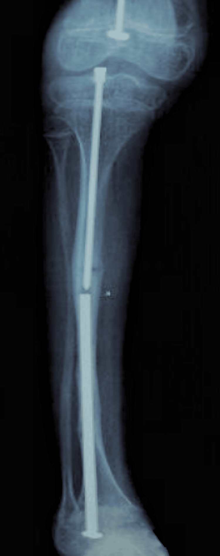 Figure 7