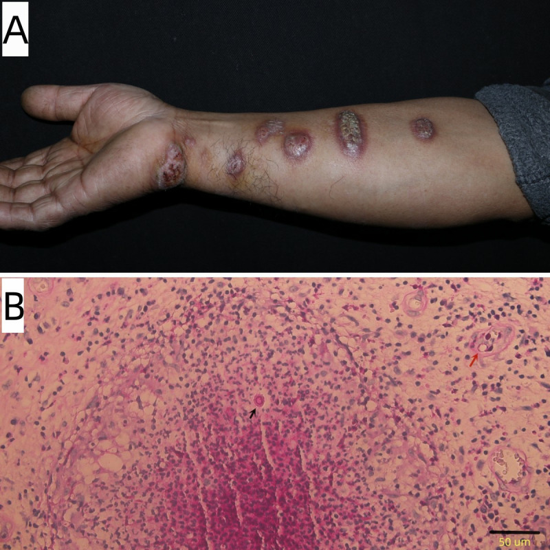 Fig 1