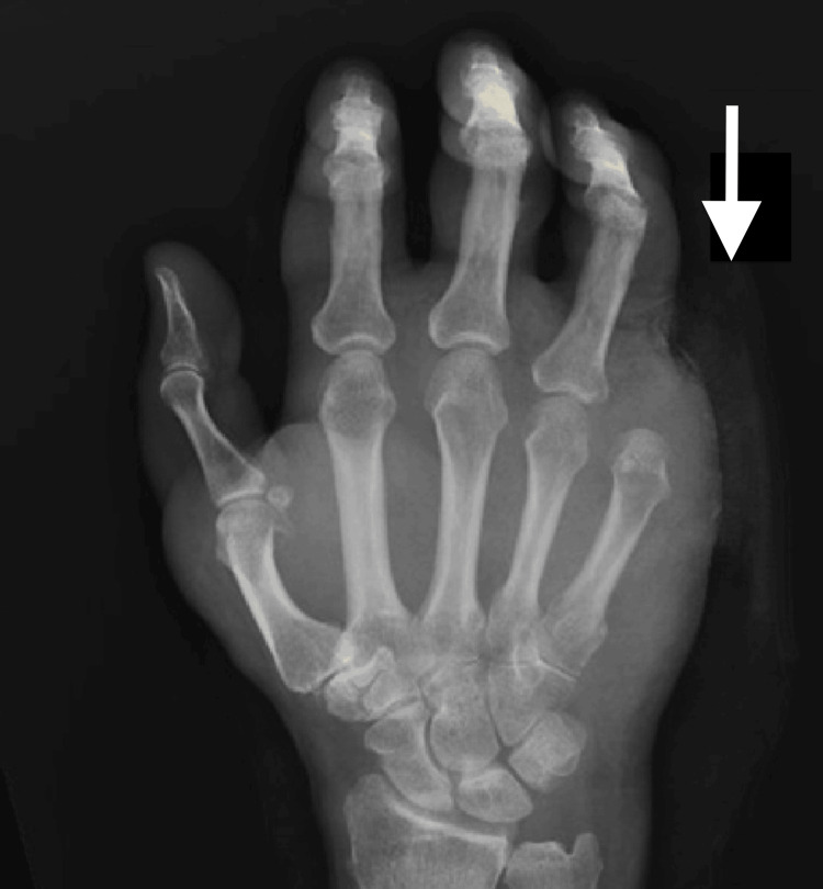 Figure 5