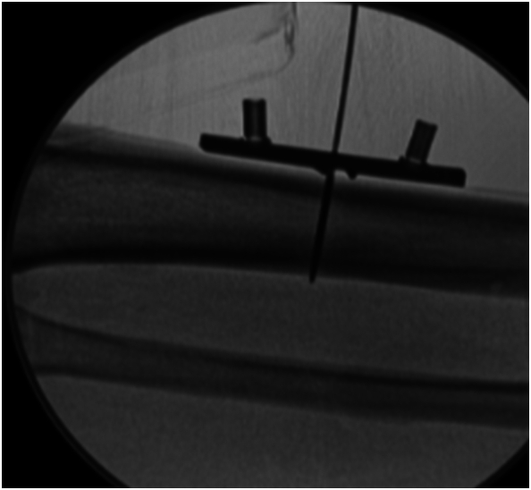 Figure 9