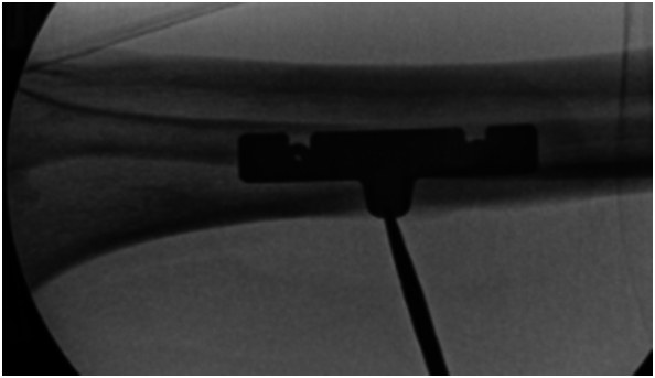 Figure 10