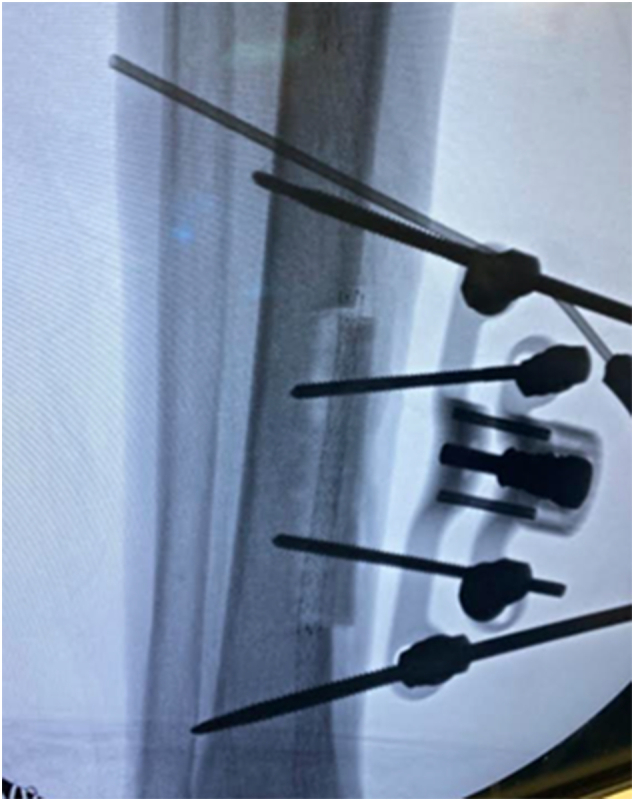 Figure 13