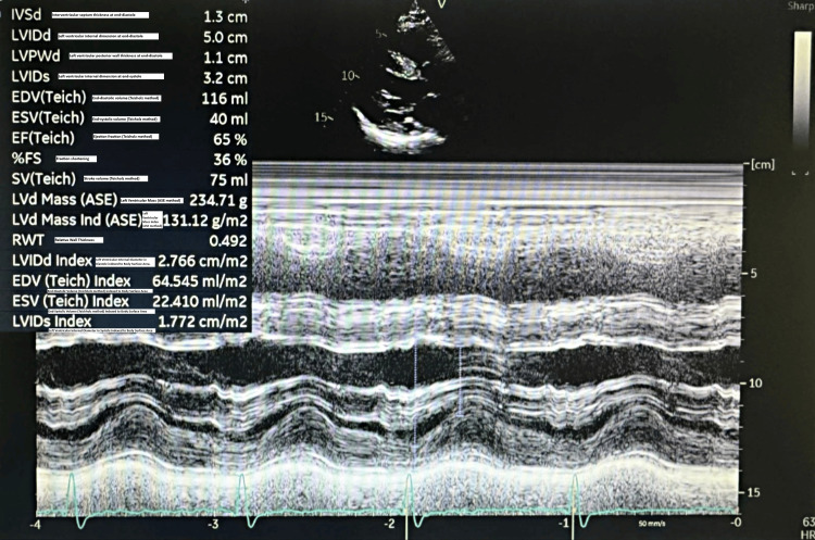 Figure 5