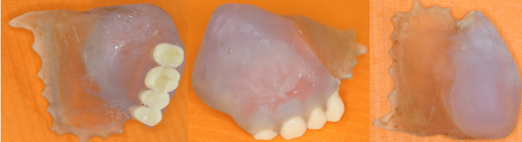 Figure 4