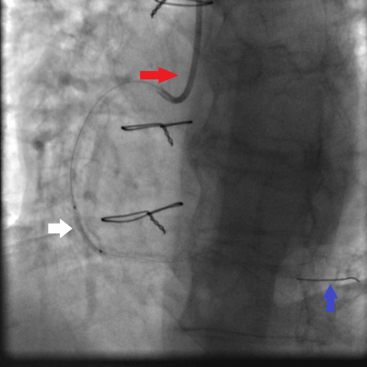 Figure 5