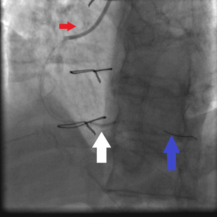 Figure 6