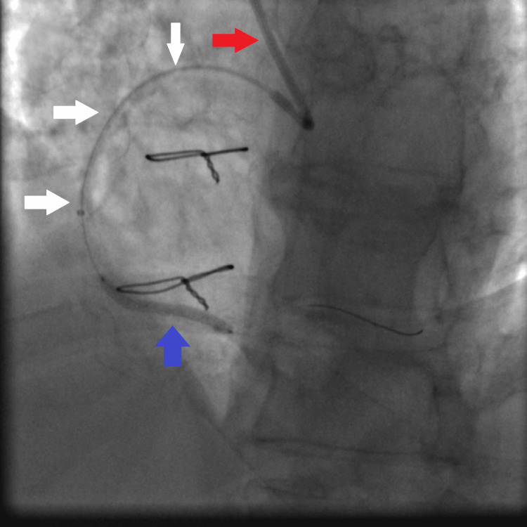 Figure 9